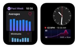 apple watch全部功能（心脏分析仪的新Apple Watch应用程序可以在您的手腕上显示详细的数据）
