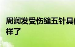 周润发受伤缝五针具体情况如何发哥现在怎么样了