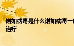 诺如病毒是什么诺如病毒一般几天能好诺如病毒症状、怎么治疗