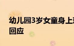 幼儿园3岁女童身上现29处针眼 幼儿园如何回应