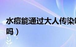 水痘能通过大人传染吗（水痘会通过大人传染吗）