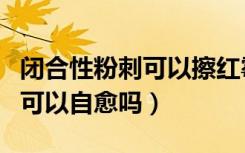 闭合性粉刺可以擦红霉素软膏吗（闭合性粉刺可以自愈吗）