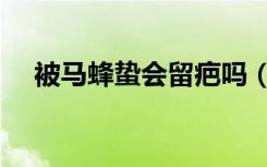 被马蜂蛰会留疤吗（被马蜂蛰会不会死）