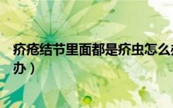 疥疮结节里面都是疥虫怎么办（疥疮结节里面都是疥虫怎么办）