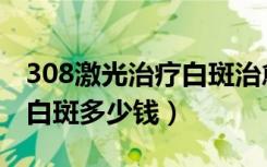 308激光治疗白斑治愈率高吗（308激光治疗白斑多少钱）