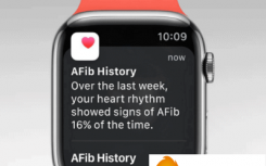 WATCHOS 9 获得加拿大对 AFIB 历史功能的批准