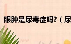 眼肿是尿毒症吗?（尿毒症眼睑浮肿的症状）