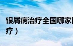 银屑病治疗全国哪家医院治疗最好（银屑病治疗）