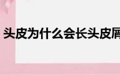 头皮为什么会长头皮屑（为什么会长头皮屑）