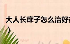 大人长痱子怎么治好得快（大人长痱子怎么治）