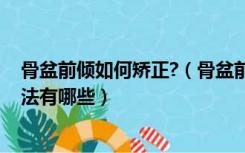 骨盆前倾如何矫正?（骨盆前倾如何纠正 骨盆前倾的矫正方法有哪些）