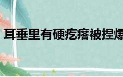 耳垂里有硬疙瘩被捏爆了（耳垂里有硬疙瘩）