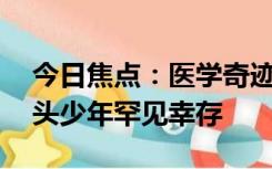 今日焦点：医学奇迹！巴勒斯坦12岁体内断头少年罕见幸存