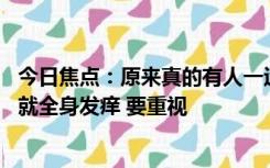 今日焦点：原来真的有人一运动就过敏：13岁男孩一打篮球就全身发痒 要重视