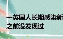 一英国人长期感染新冠导致腿变蓝，科学家：之前没发现过