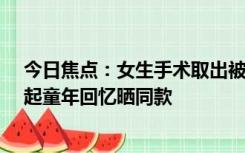 今日焦点：女生手术取出被戳进额头20年铅笔芯 网友被勾起童年回忆晒同款