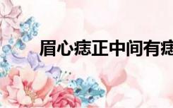 眉心痣正中间有痣的女人（眉心痣）