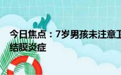 今日焦点：7岁男孩未注意卫生致猫毛入眼后手术取出 导致结膜炎症