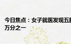 今日焦点：女子就医发现五脏六腑全长反 全球发生率仅为百万分之一