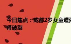 今日焦点：成都2岁女童遭烈犬撕咬入院治疗，知情人：右肾破裂