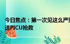 今日焦点：第一次见这么严重的！10个月宝宝食指倒刺被拔送PICU抢救