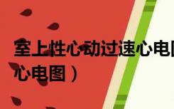 室上性心动过速心电图讲解（室上性心动过速心电图）