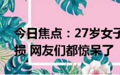 今日焦点：27岁女子长期横向刷牙致牙齿缺损 网友们都惊呆了