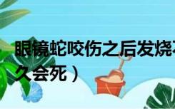 眼镜蛇咬伤之后发烧不喝水（眼镜蛇咬伤后多久会死）