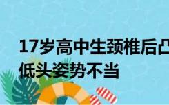 17岁高中生颈椎后凸堪比47岁，医生：长期低头姿势不当