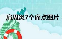 肩周炎7个痛点图片（肩部疼痛怎么缓解）