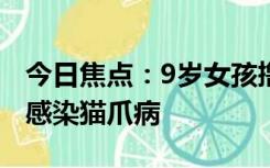 今日焦点：9岁女孩撸猫被抓后视力降至0.1：感染猫爪病