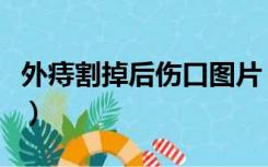 外痔割掉后伤口图片（痔疮手术伤口恢复图片）